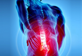 Back Pain