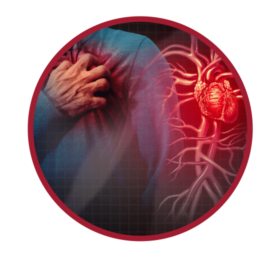 cardiac disorder
