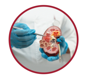 Kidney issues