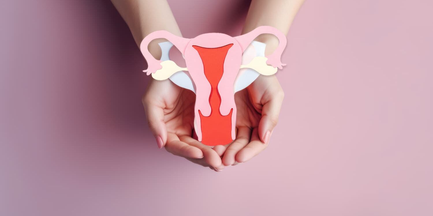 PCOS