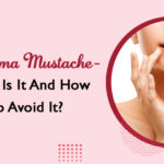 Melasma Mustache- What Is It And How To Avoid It