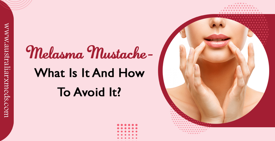 Melasma Mustache- What Is It And How To Avoid It