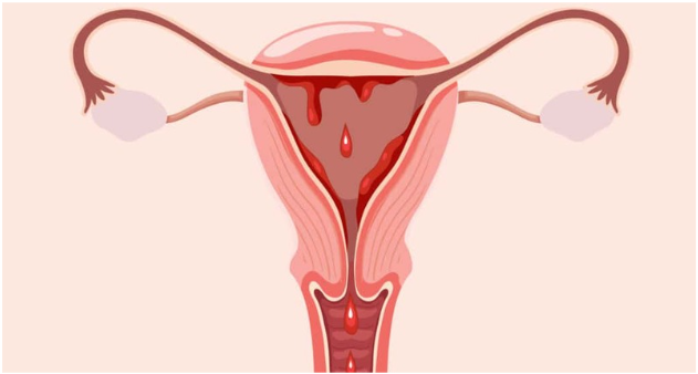 Menstruation