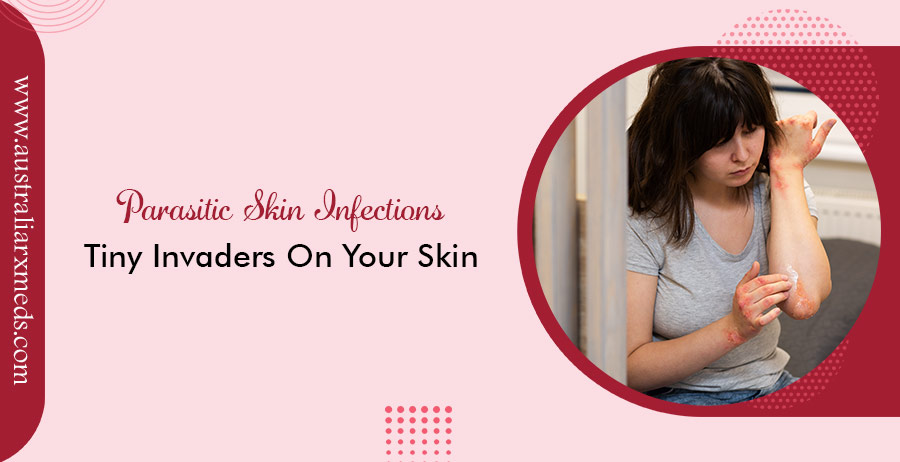 Skin Infection