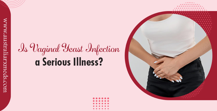 Is Vaginal Yeast Infection a Serious Illness?