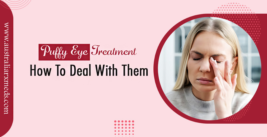 Puffy Eye Treatment - How To Deal With Them