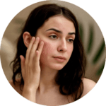 Light Sensitivity skin