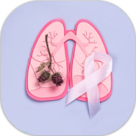 Lung Cancer