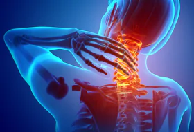 Neck Pain