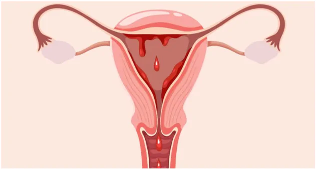 Menstruation