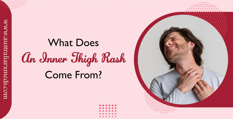 What Does an Inner Thigh Rash Come From?